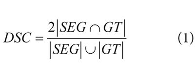 Energy minimization segmentation model based on MRI images